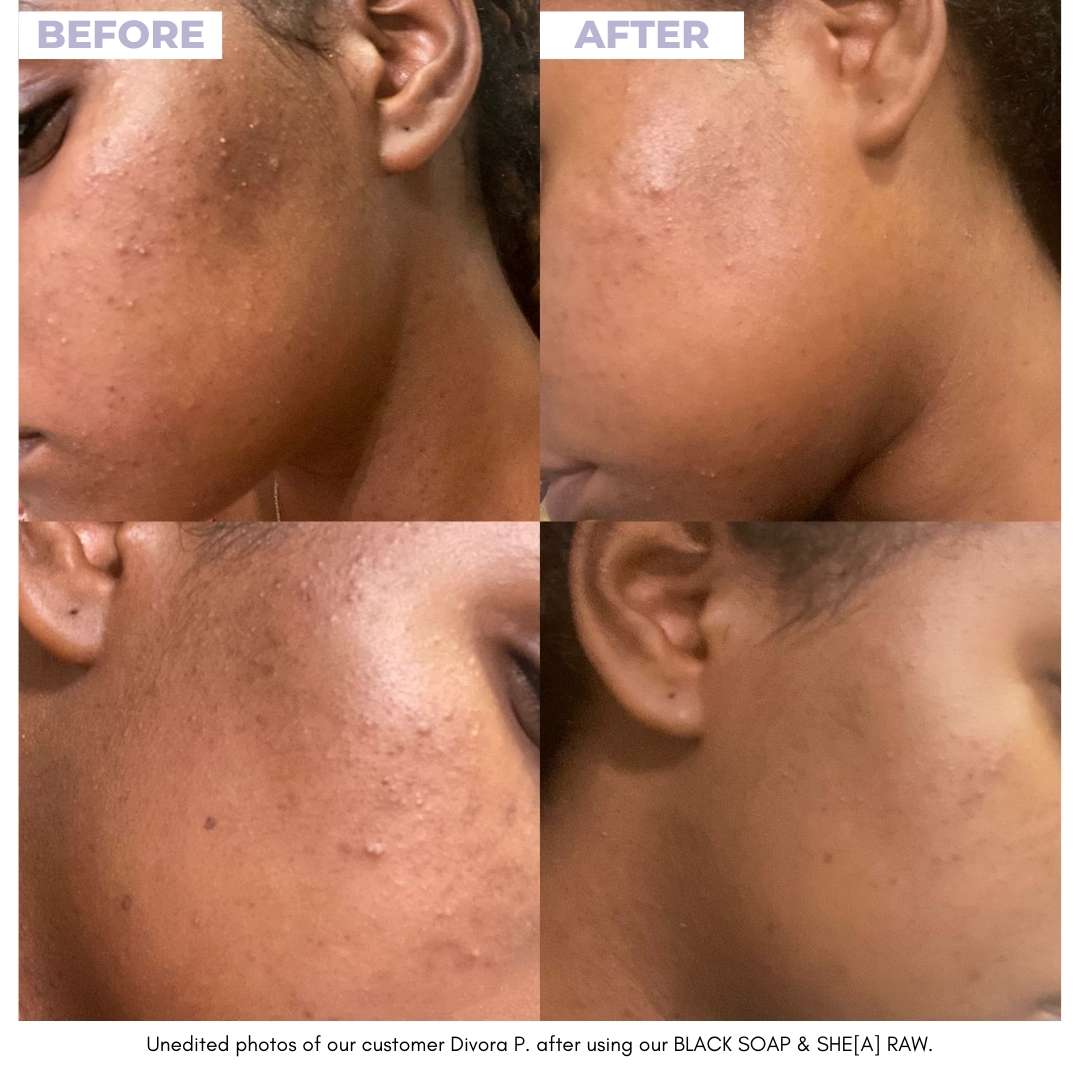 GLOW DUOs - Unrefined Riches