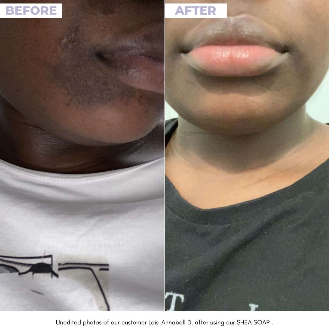 SHEA SOAP - Unrefined Riches