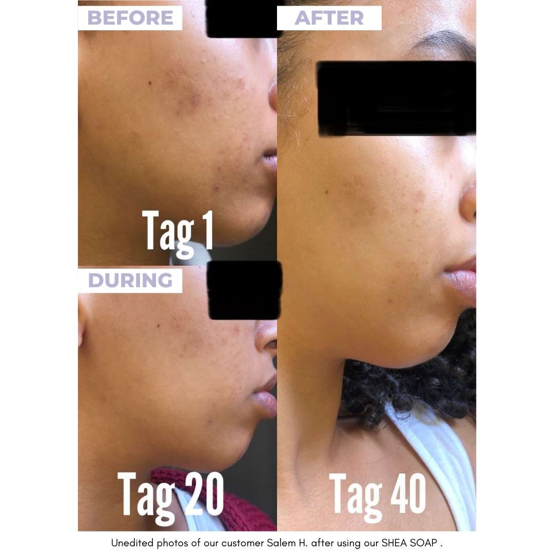 SHEA SOAP - Unrefined Riches