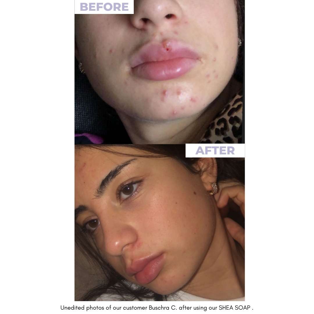 SHEA SOAP - Unrefined Riches