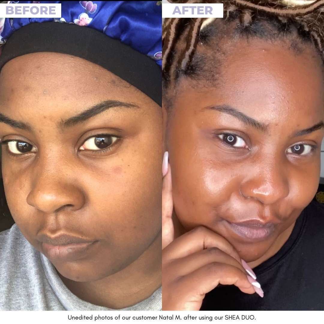 SHEA DUO - Unrefined Riches