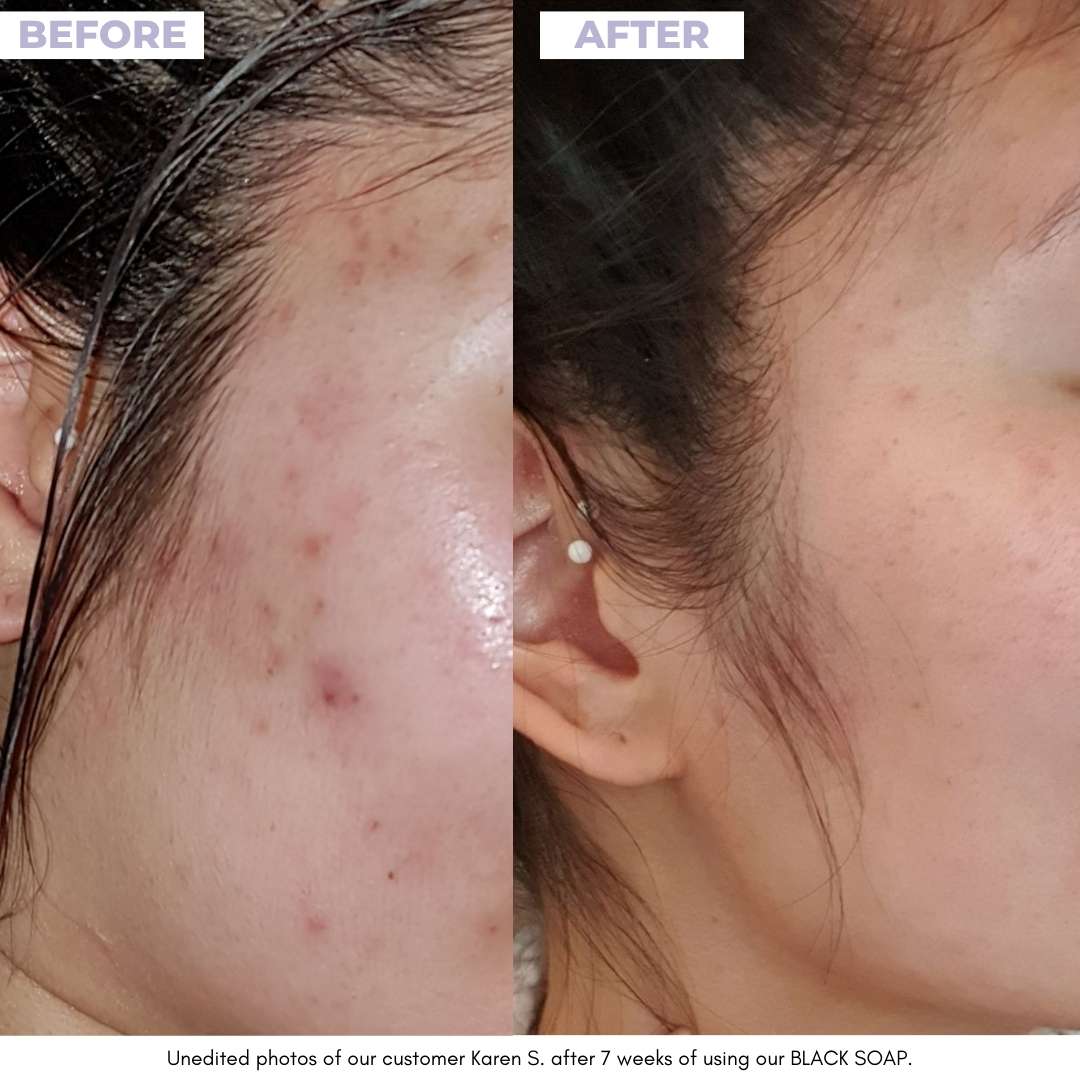 BLACK SOAP - afrikanische schwarze Seife - Unrefined Riches