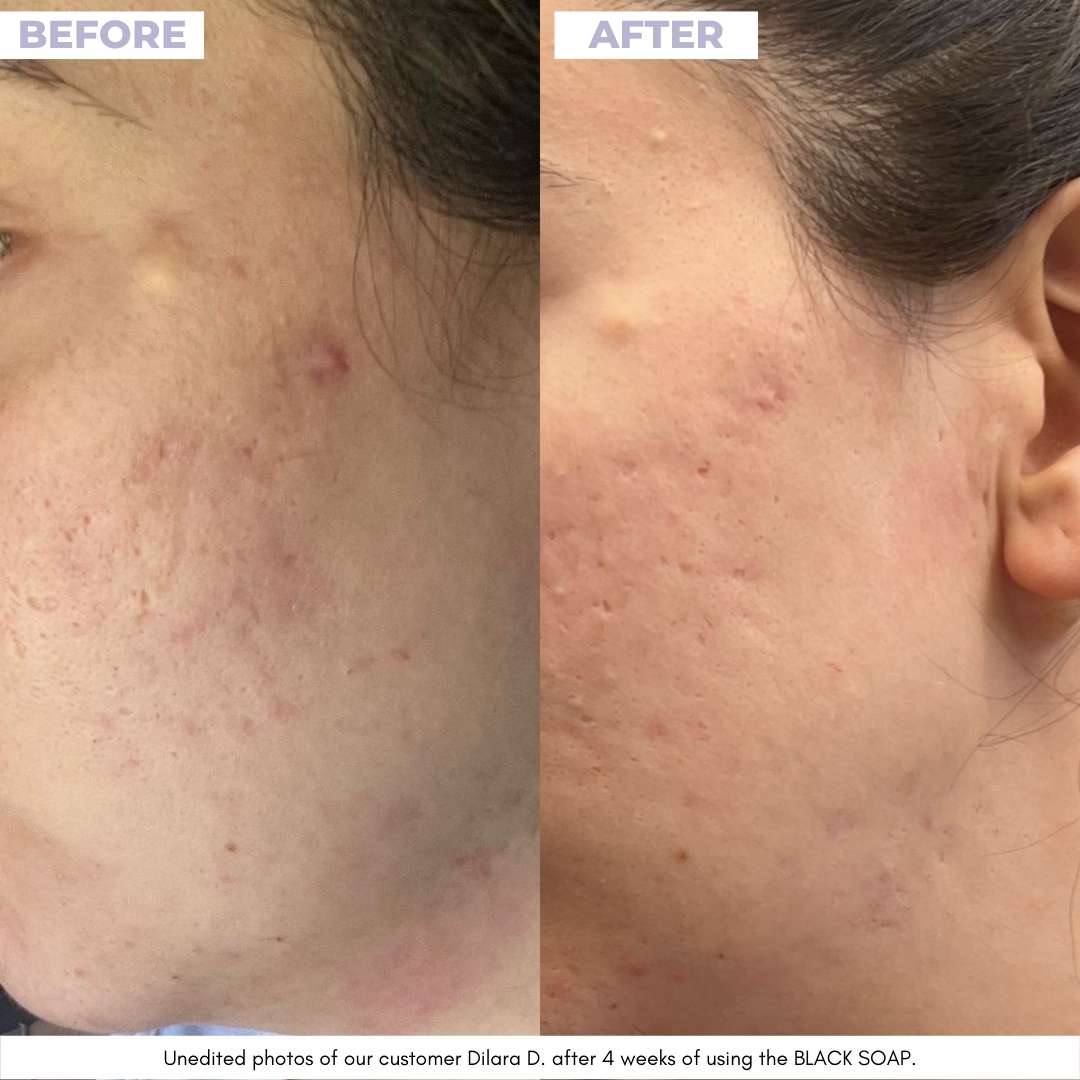 BLACK SOAP - afrikanische schwarze Seife - Unrefined Riches