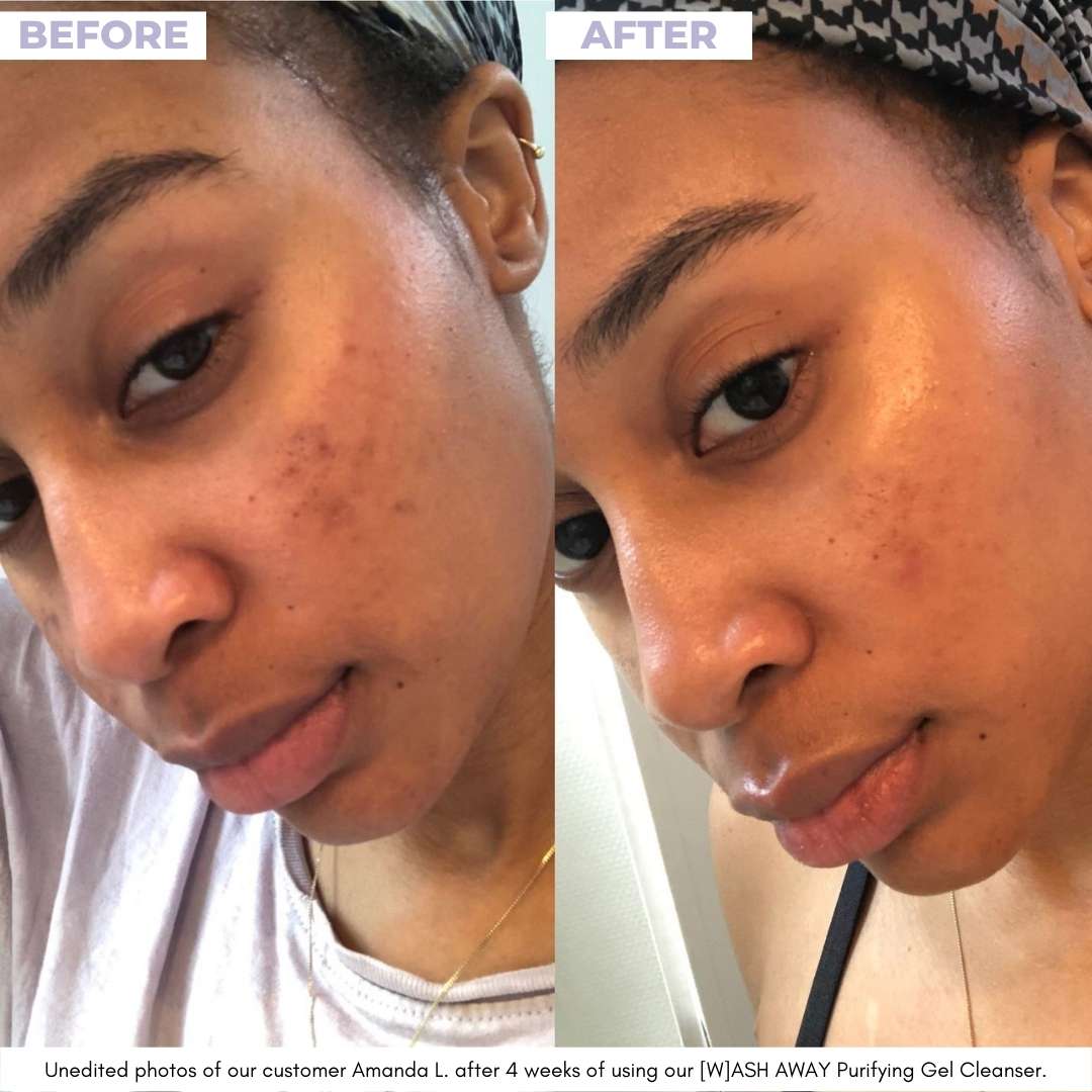 [W]ASH AWAY - Purifying Gel Cleanser - Unrefined Riches