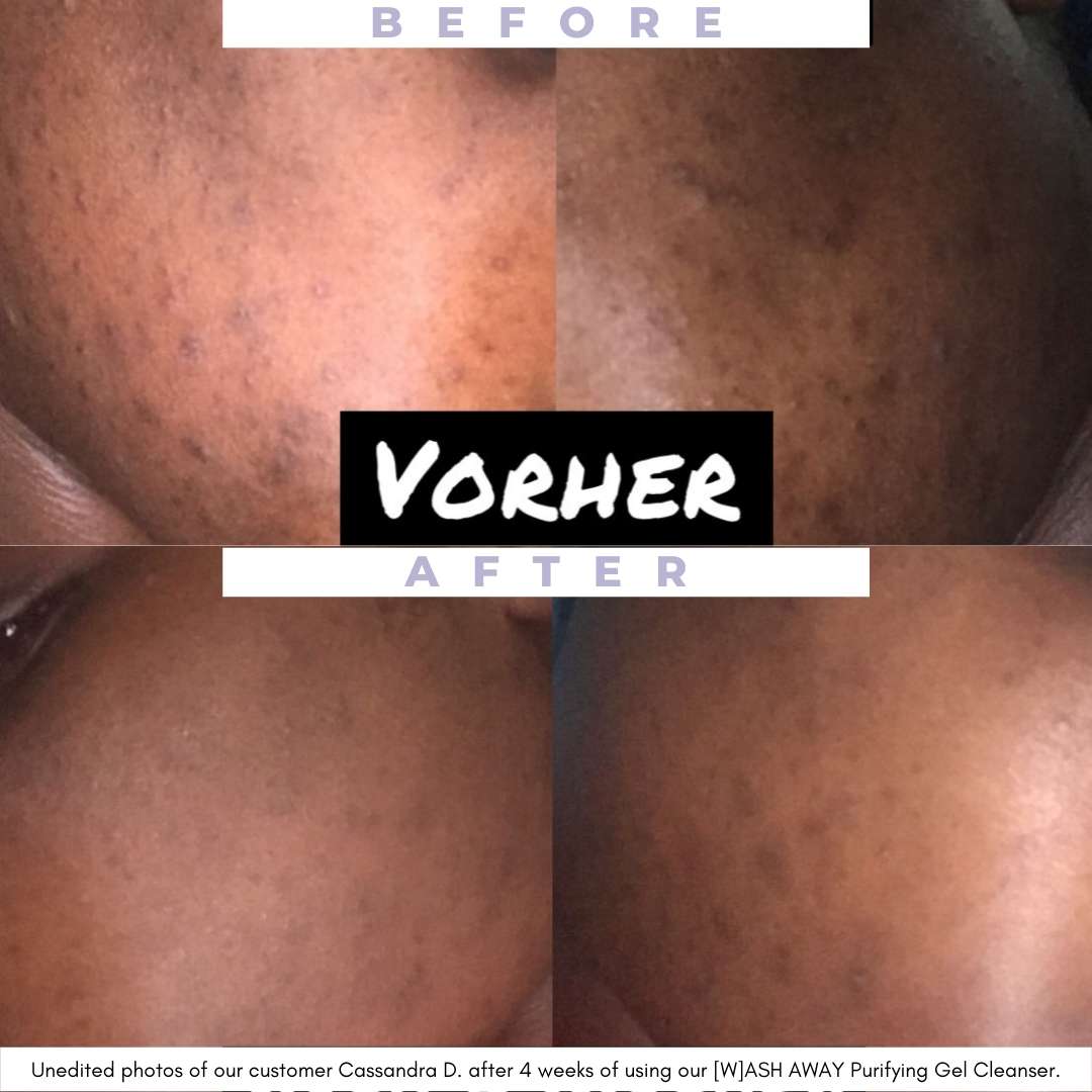 [W]ASH AWAY - Purifying Gel Cleanser - Unrefined Riches