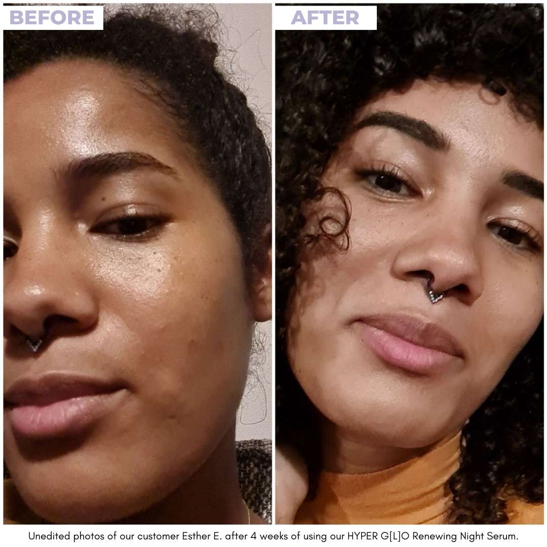 HYPER G[L]O - Renewing Night Serum - Unrefined Riches