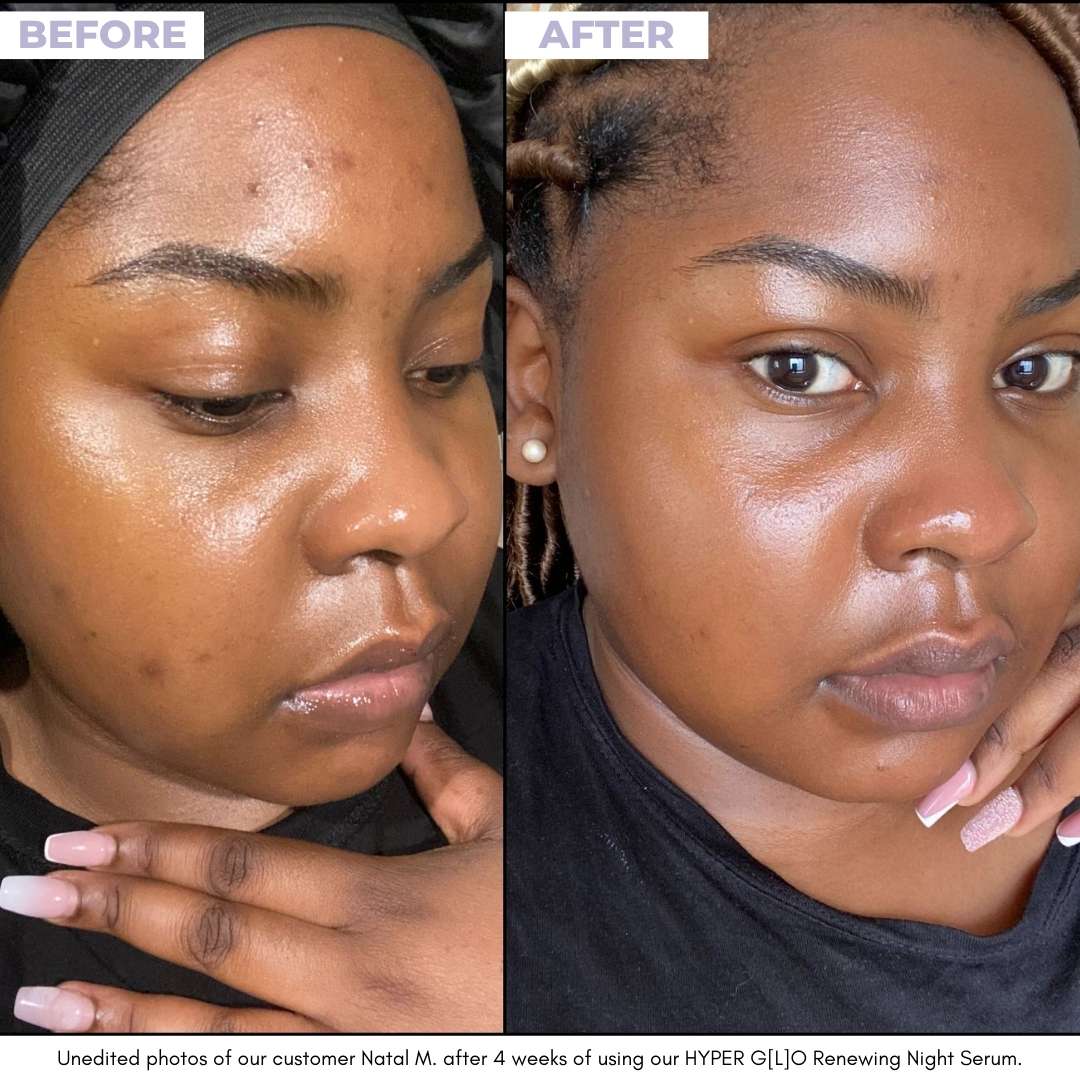 HYPER G[L]O - Renewing Night Serum - Unrefined Riches