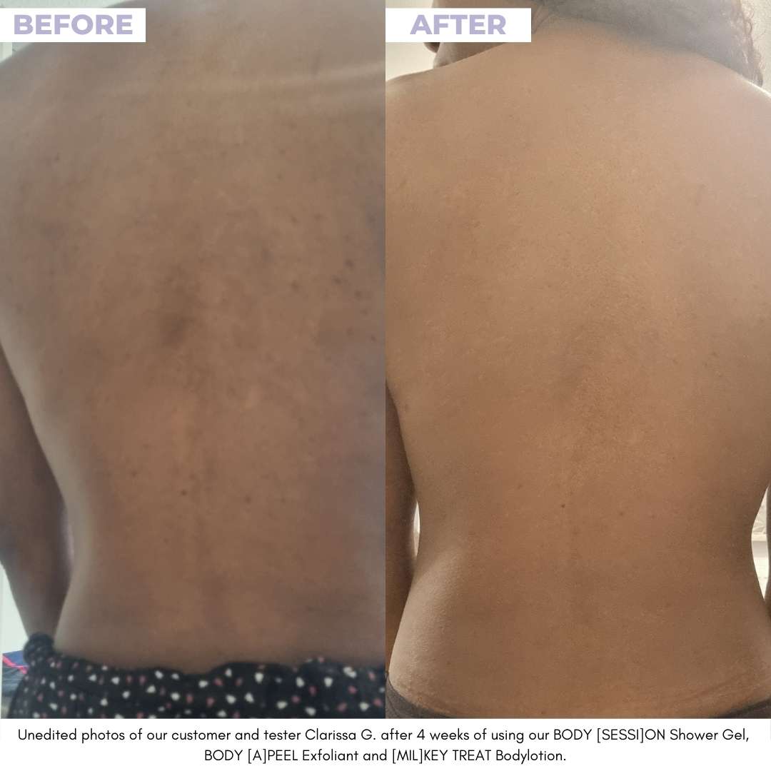 BODY [A]PEEL - Renewing Gel Exfoliant - Unrefined Riches