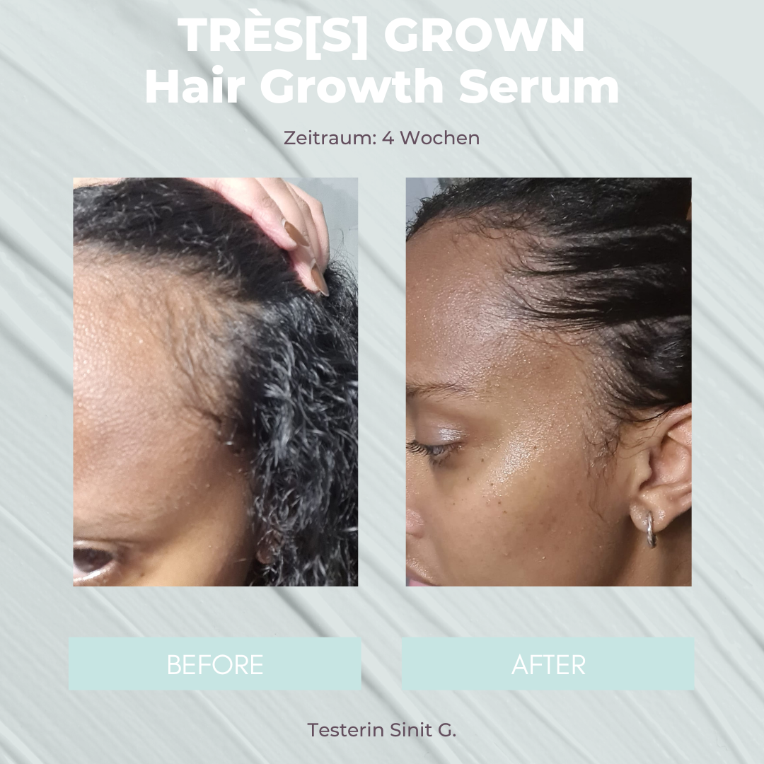 TRÈS[S] GROWN - HAIR GROWTH SERUM - Unrefined Riches