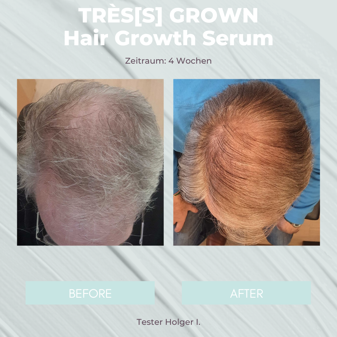 TRÈS[S] GROWN - HAIR GROWTH SERUM - Unrefined Riches