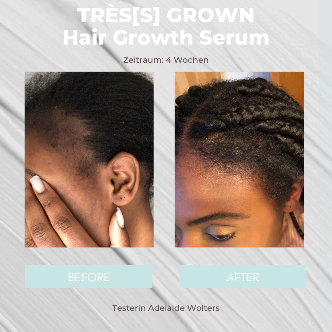TRÈS[S] GROWN - HAIR GROWTH SERUM - Unrefined Riches